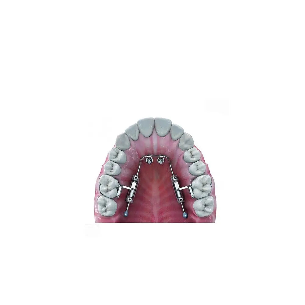 Dentaurum Amda advanced molar distalization appliance
