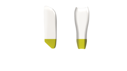 BTLI-Yellow-416×234