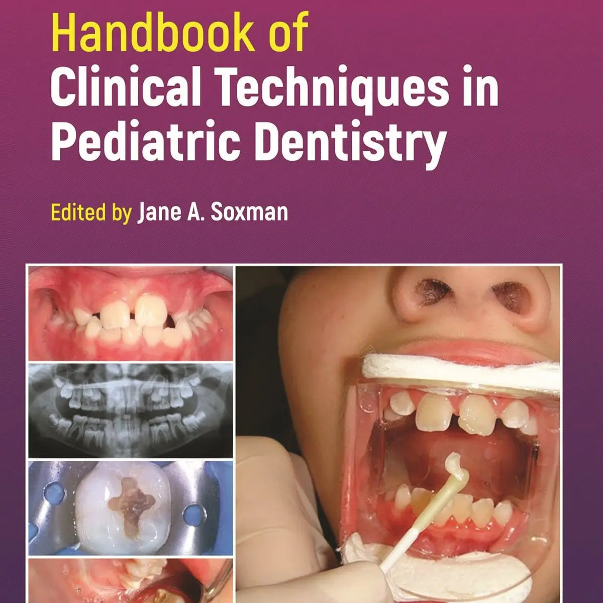 Handbook of Clinical Techniques in Pediatric Dentistry 2022 – MedSTA