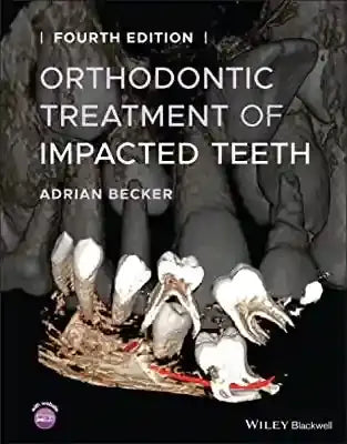 Orthodontic Treatment Of Impacted Teeth 2022