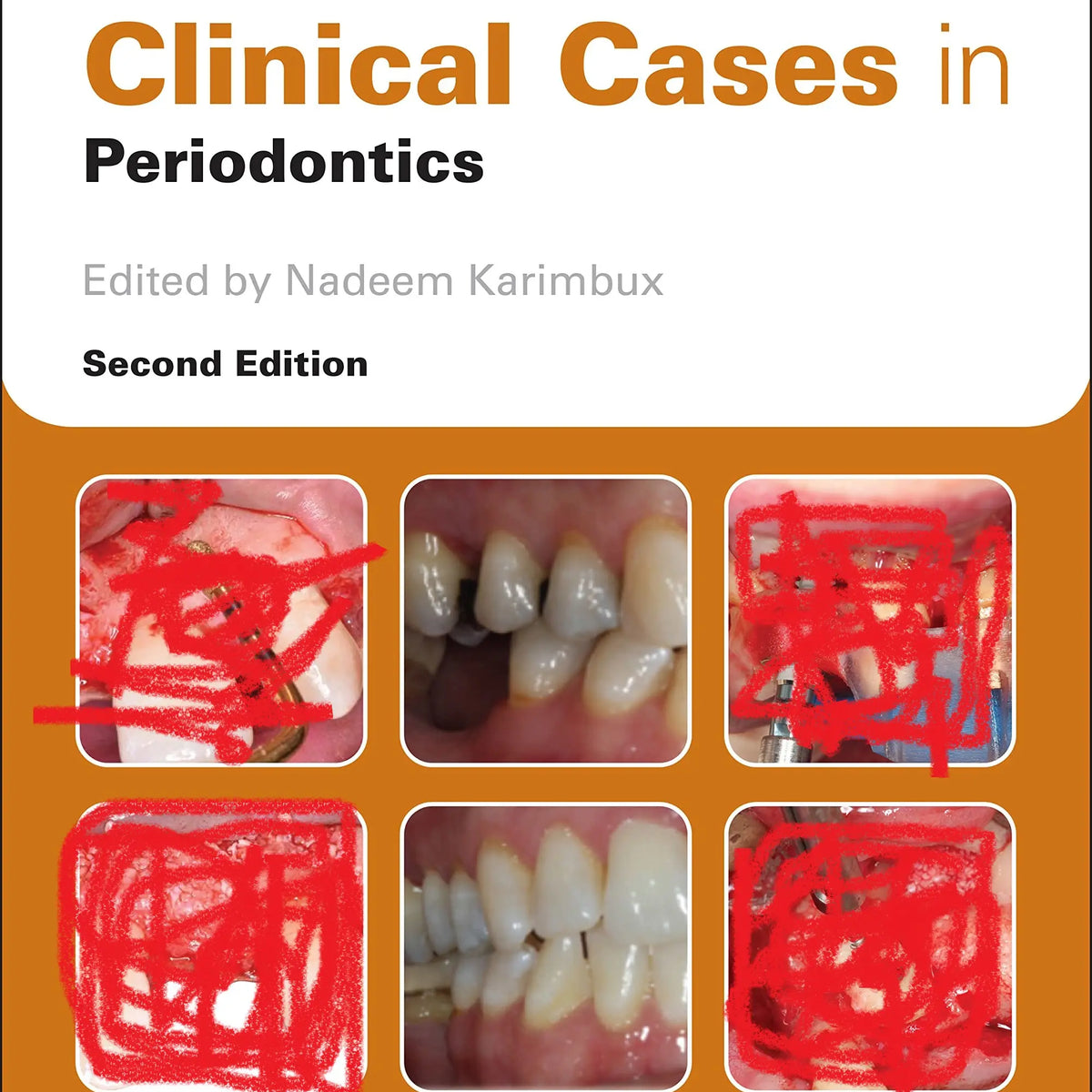 Clinical cases in periodontics 2022 – MedSTA