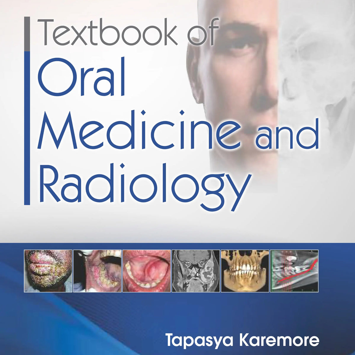 Textbook of Oral Medicine & Radiology 2021 – MedSTA