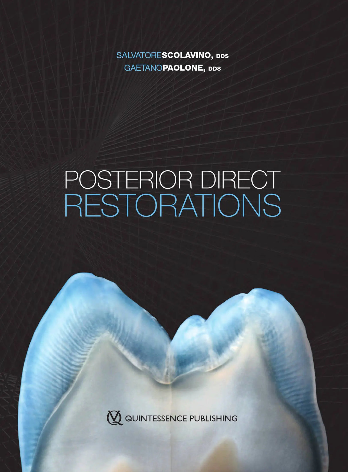 Posterior Direct Restorations 2021