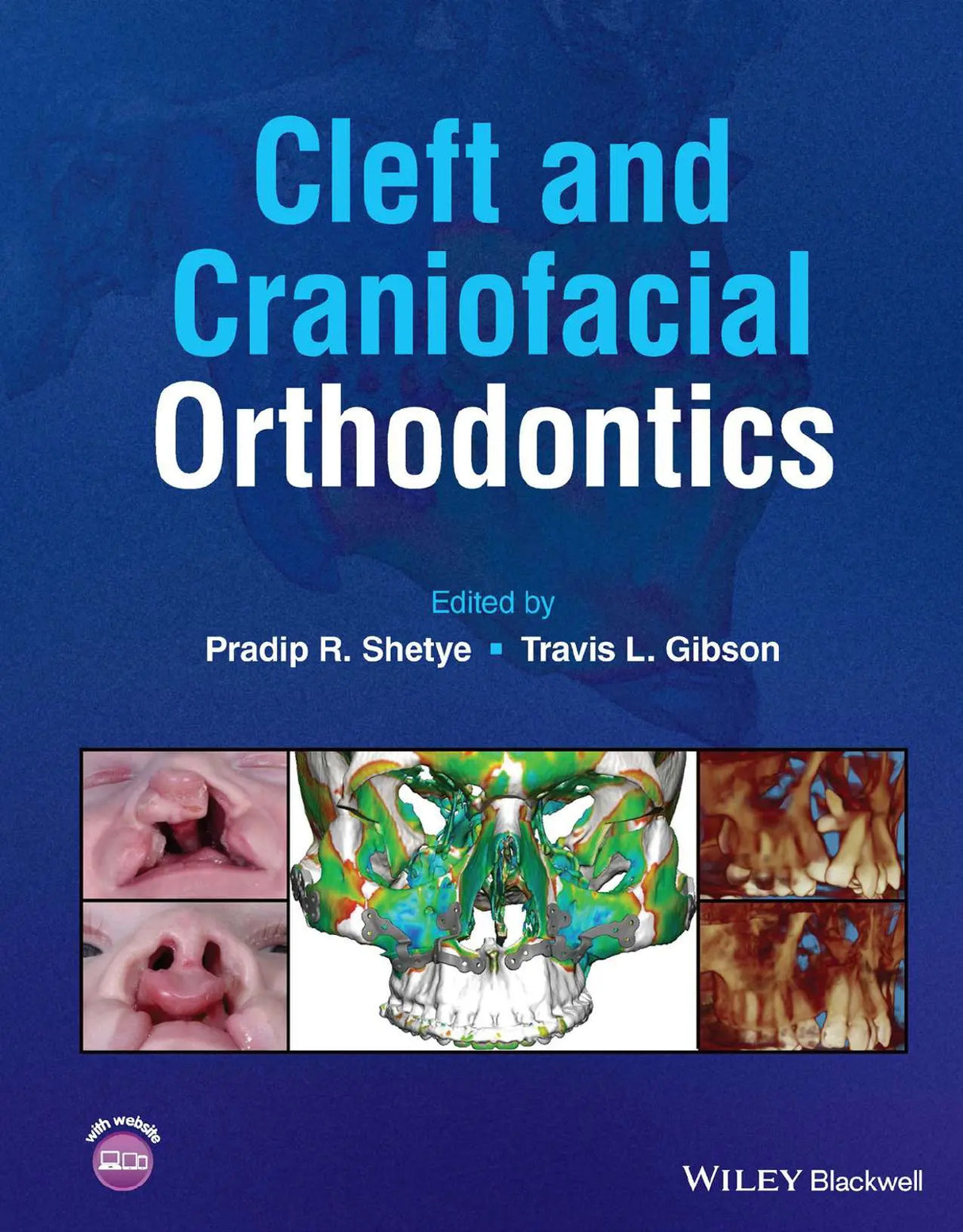 Cleft and Craniofacial Orthodontics 2023