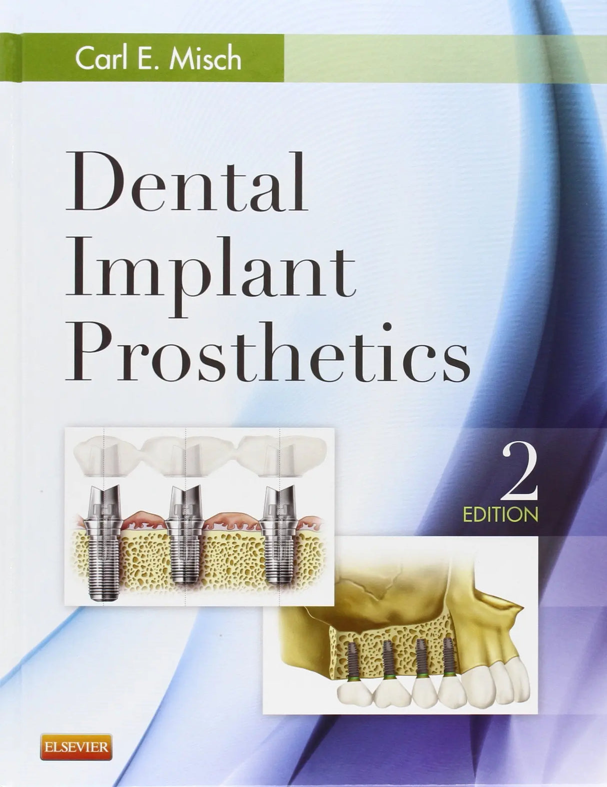 Dental Implant Prosthetics 2014