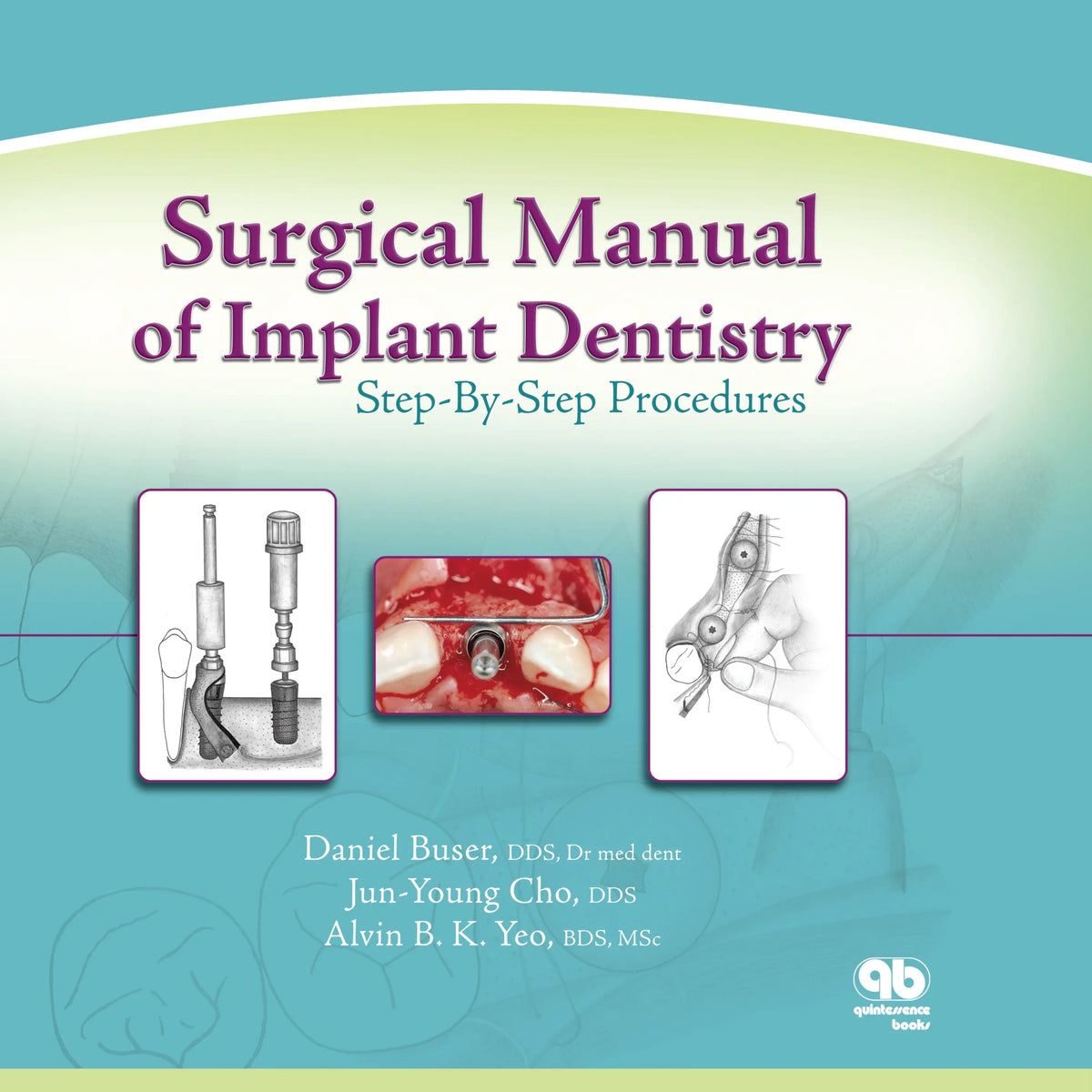 Surgical Manual of Implant Dentistry Step-By-Step Procedures 2007 – MedSTA