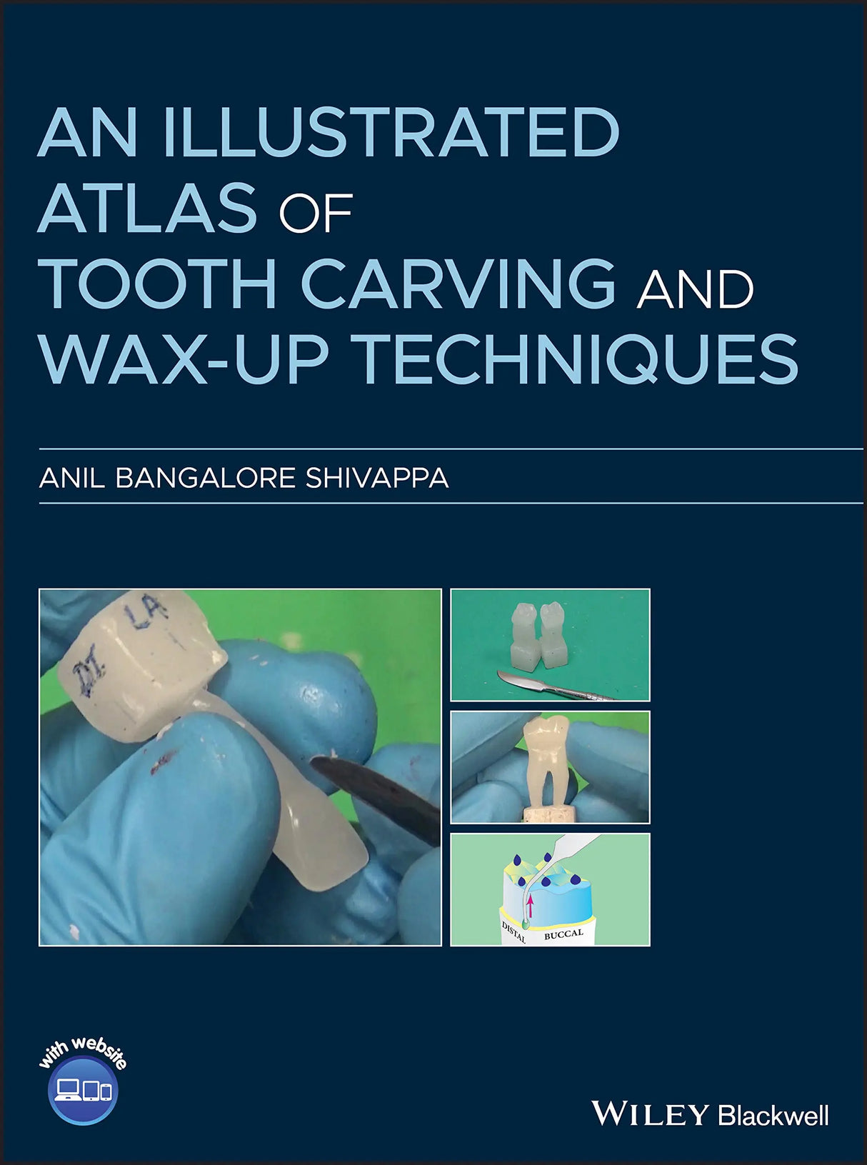 An ILLustrated Atlas of Tooth Carving and Wax-Up Techniques 2021