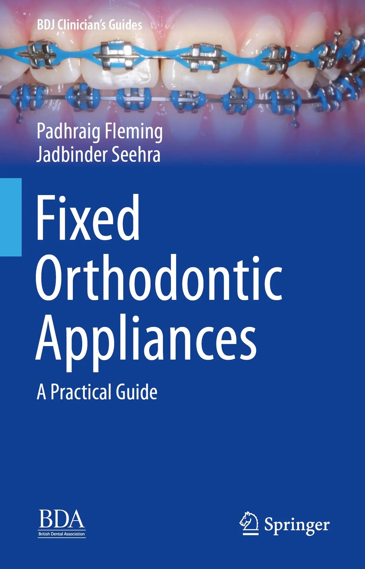 Fixed Orthodontic Appliances 2019