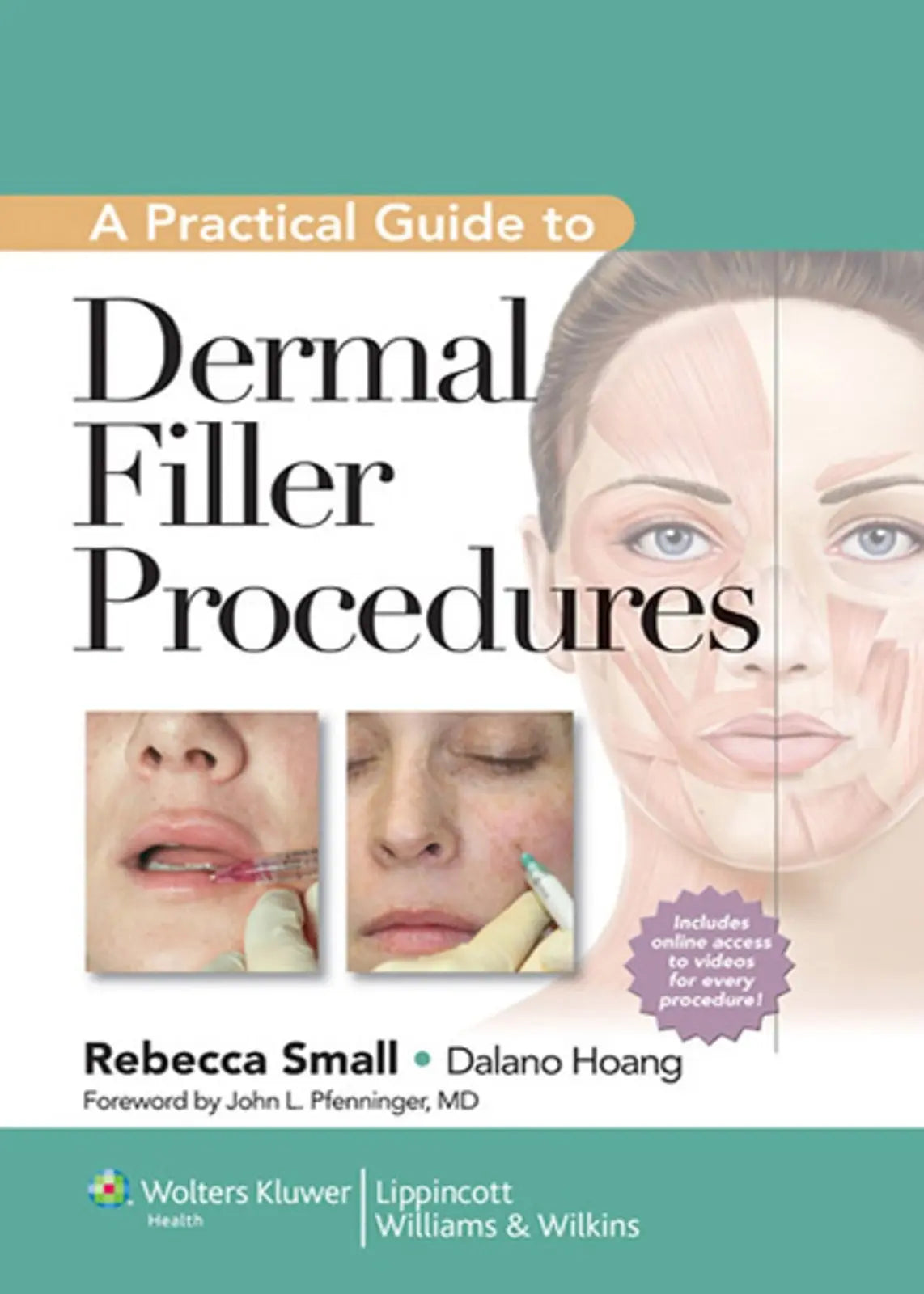 A Practical Guide to Dermal Filler Procedures 2012