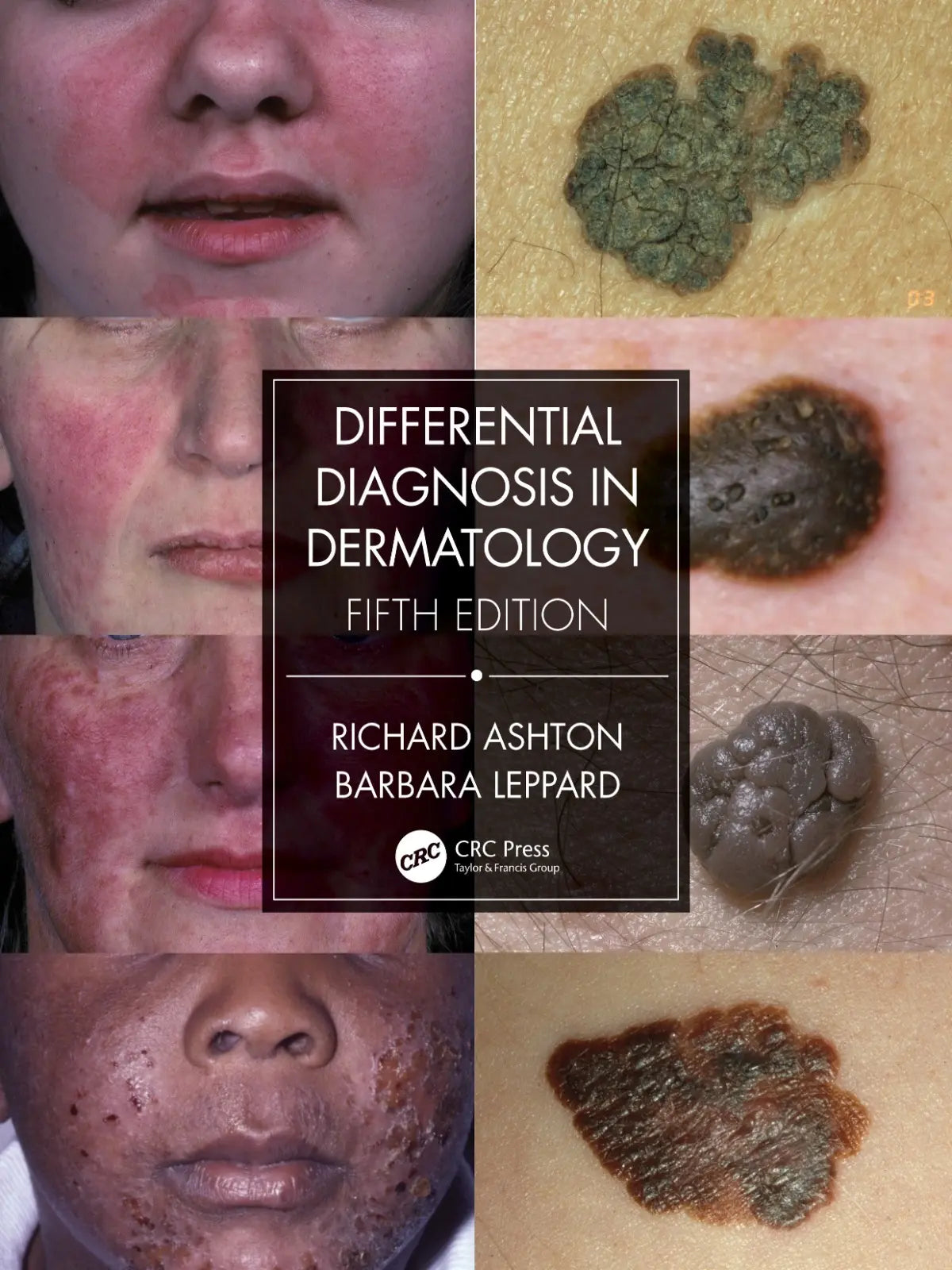 Differential Diagnosis in Dermatology 2021