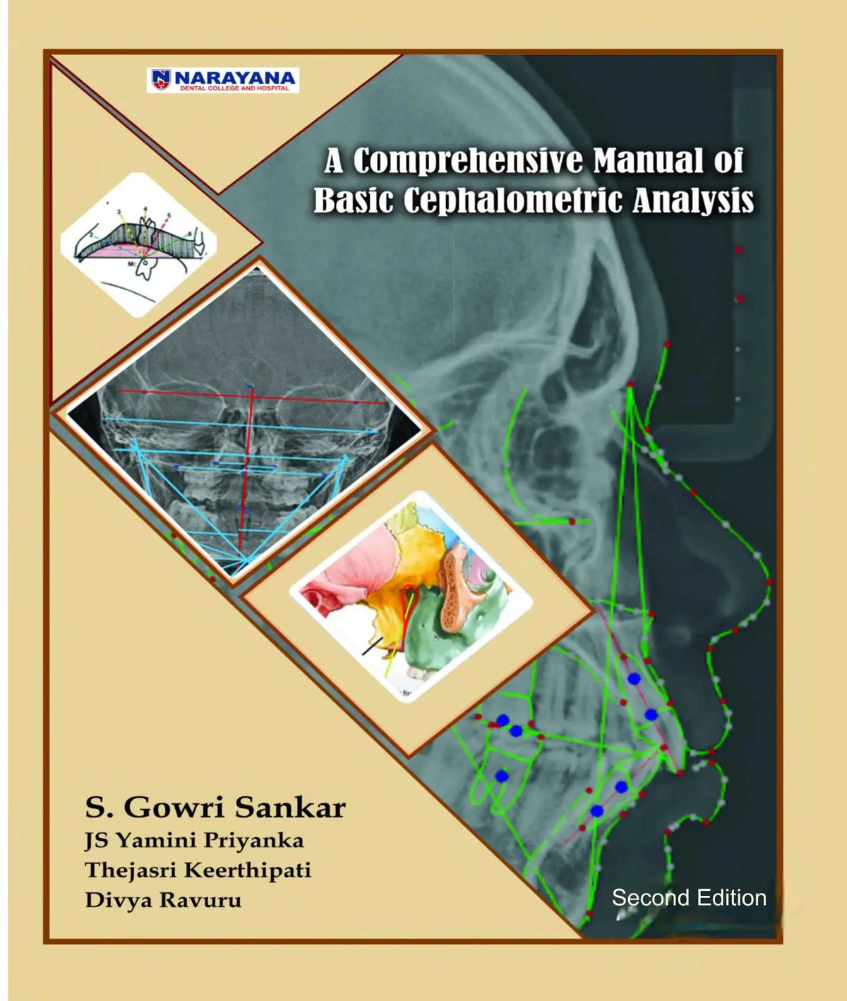 A Comprehensive Manual of Basic Cephalometric Analysis 2025