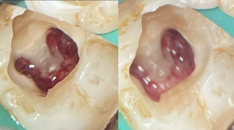 Pulp Preservation, a new principle, a New Norm