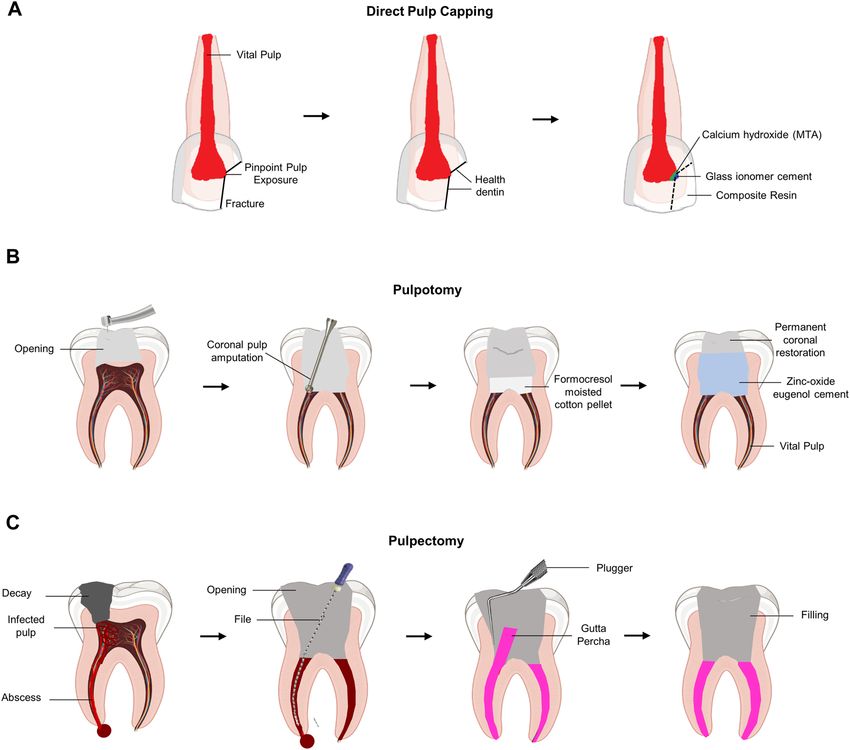 Contemporary management of Primary Teeth: Balancing Minimal Intervention and Biological Respect
