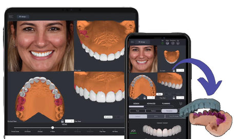 Facially Driven Smile Design and Direct Composite Veneers