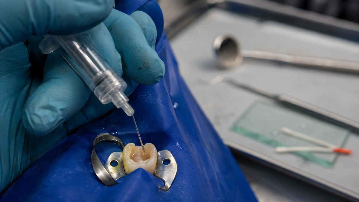 Dentist performing root canal irrigation with a side-vented syringe on an isolated molar using a blue rubber dam during endodontic treatment.