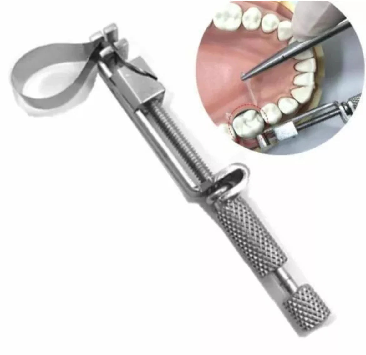 Tofflemire Matrix Bands retainer