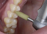 Shofu CompoMaster CA finishing, polishing, and super polishing composite Burs