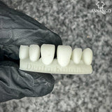 3d Composite cast