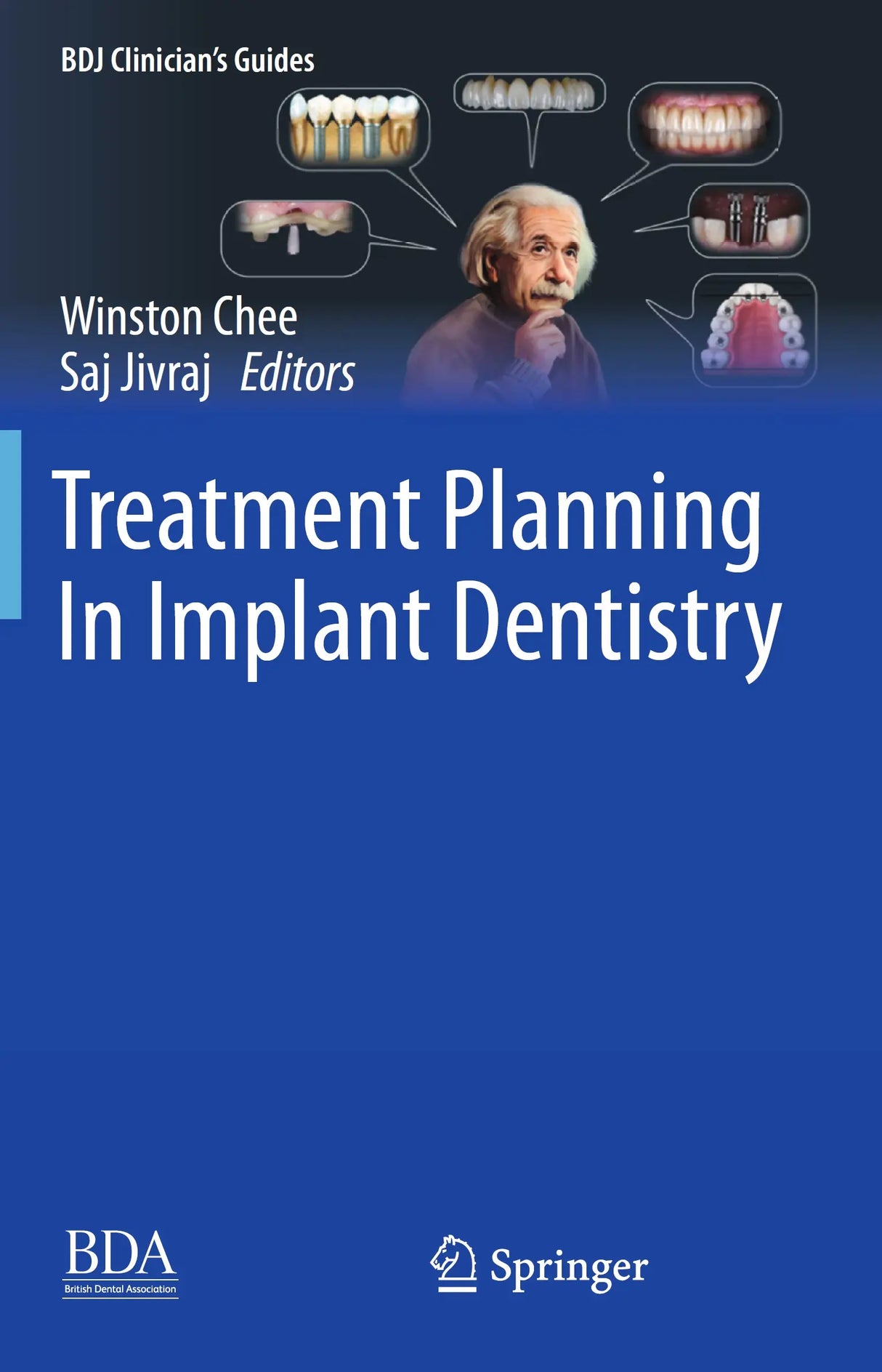 Treatment Planning In Implant Dentistry 2024