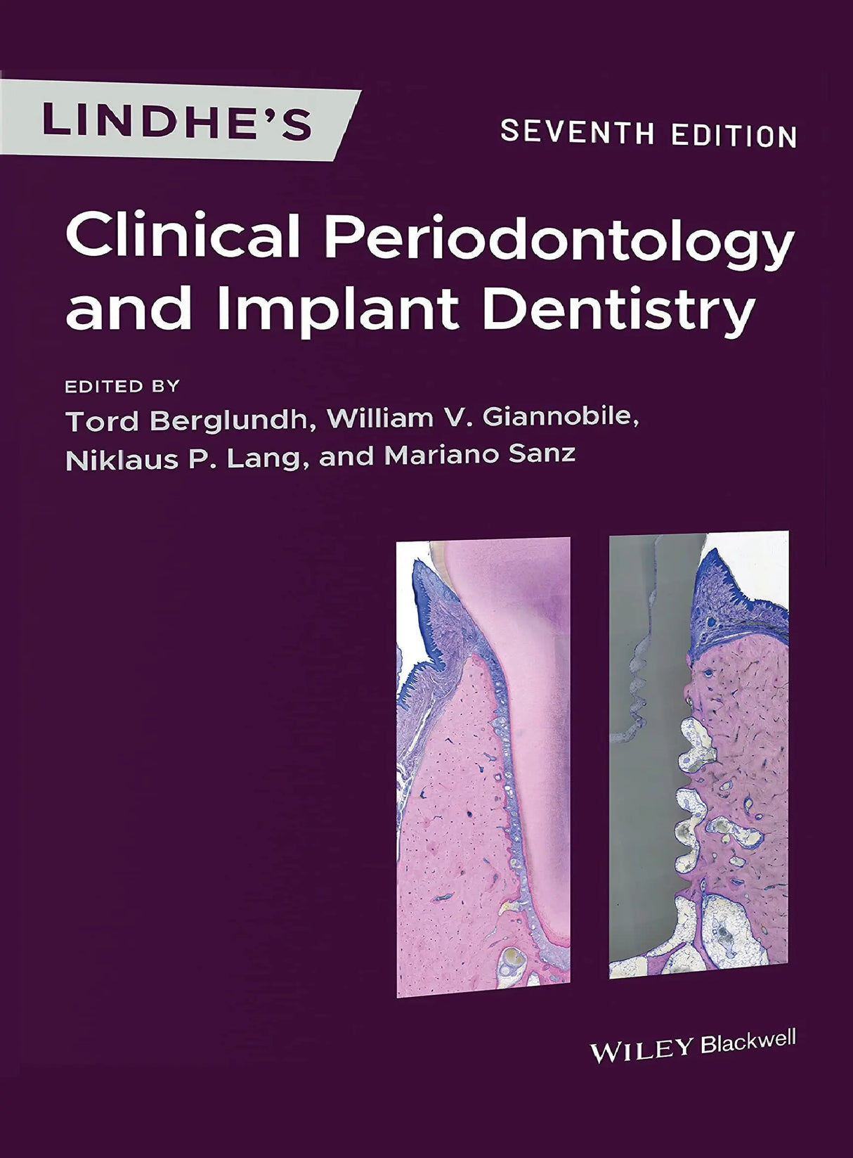 Lindhe’s Clinical Periodontology & Implant Dentistry 2022