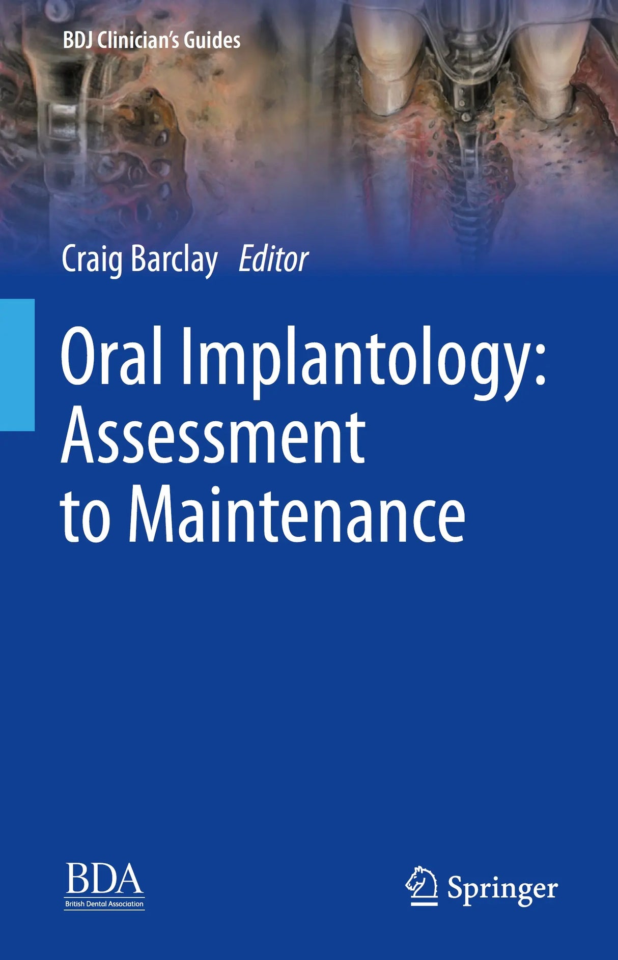 Oral Implantology Assessment to Maintenance 2024