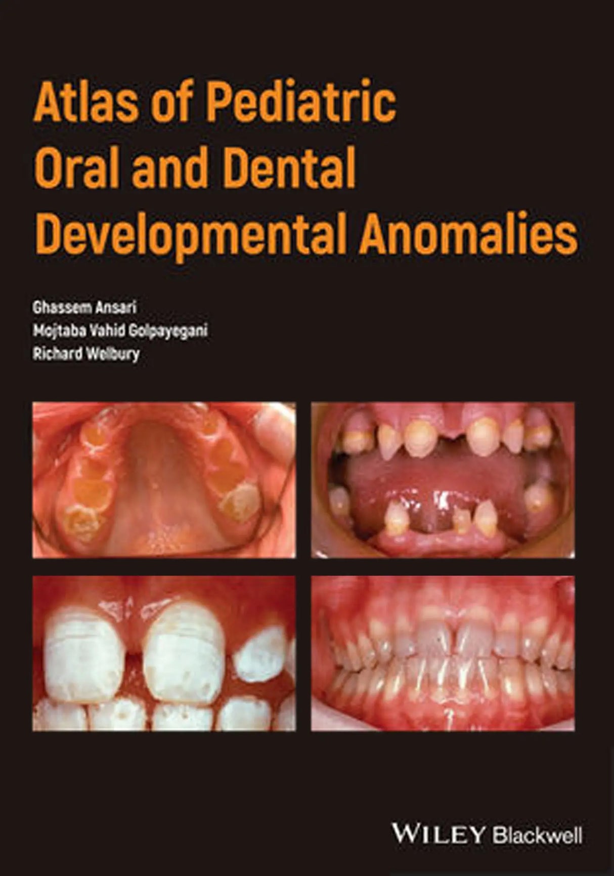 Atlas of Pediatric Oral and Dental Developmental Anomalies 2019