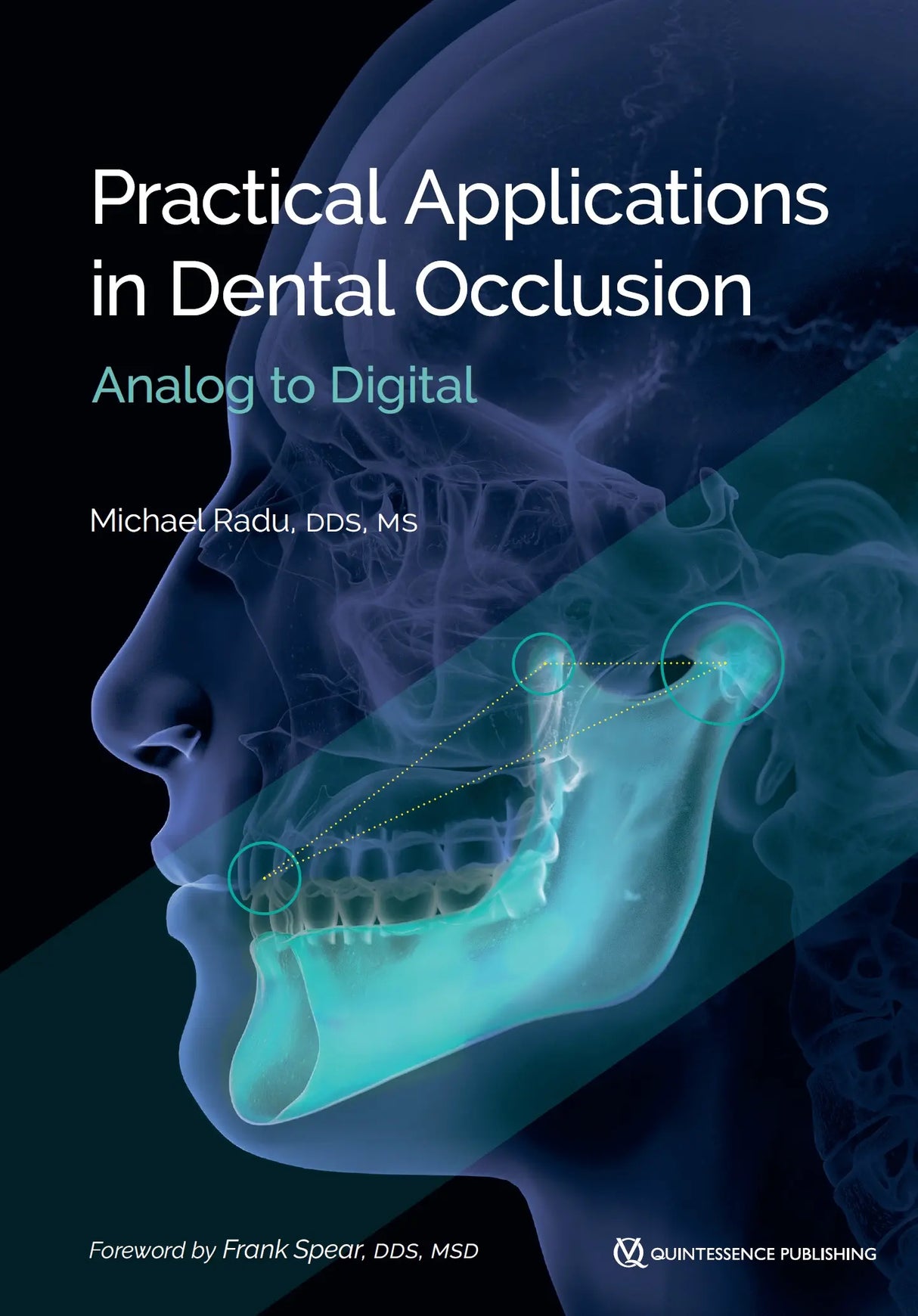 Practical Applications in Dental Occlusion Analog to Digital 2024