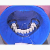 Optradam dam and flexible anatomical frame in one piece