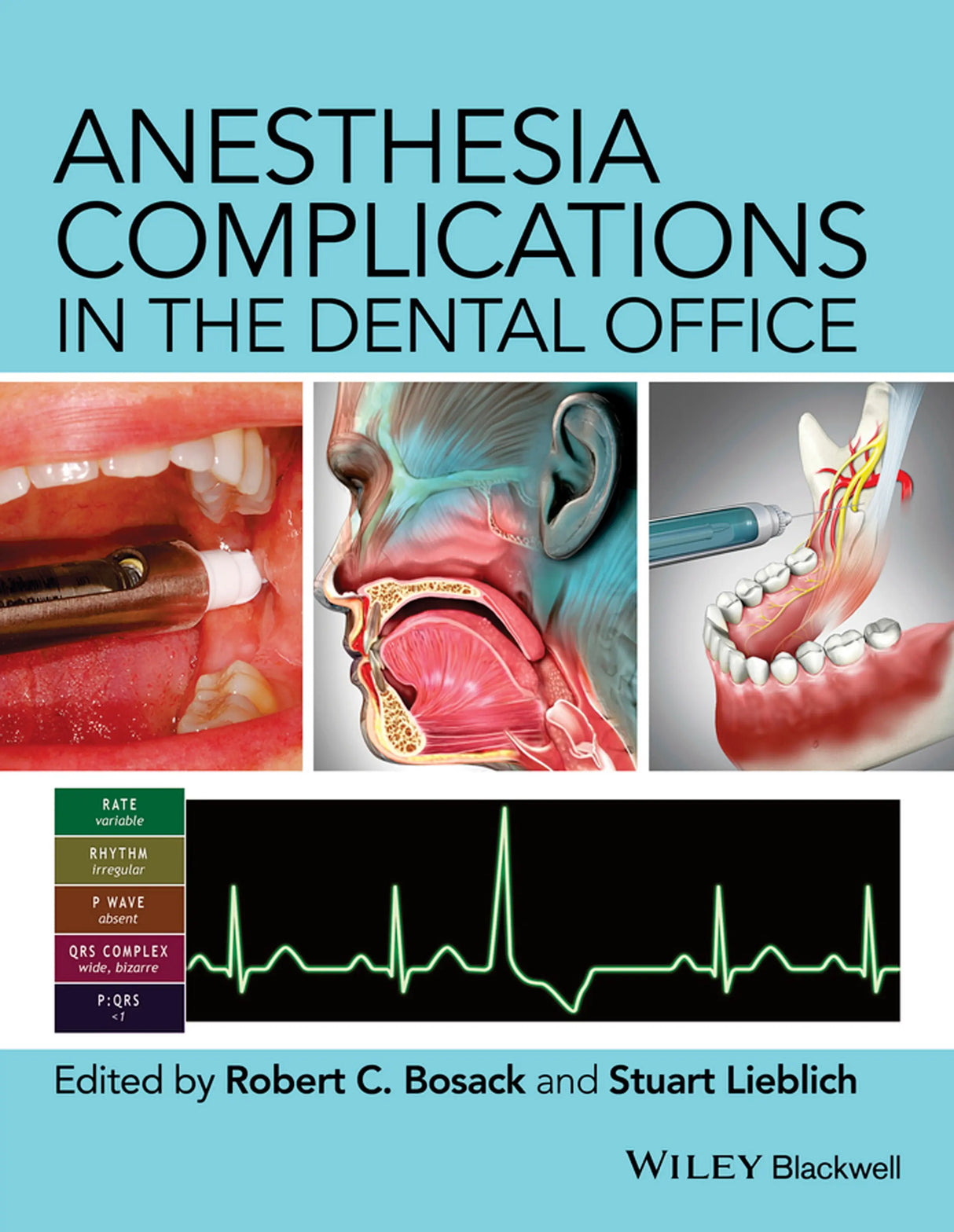 Anesthesia complications in the dental office 2015