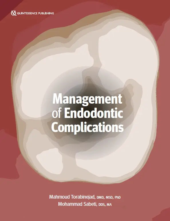 Management of Endodontic Complications From Diagnosis to Prognosis 2023
