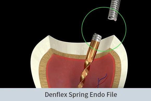DENFLEX High plus refill Endodontics files