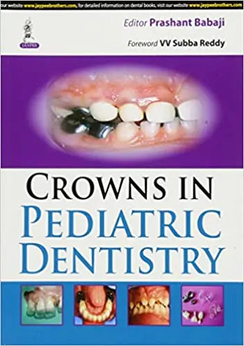 Crowns in Pediatric Dentistry 2015