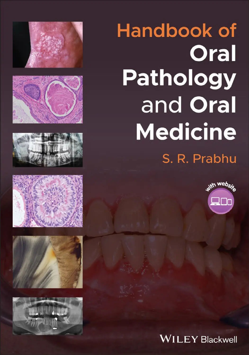 Handbook of Oral Pathology and Oral Medicine 2022