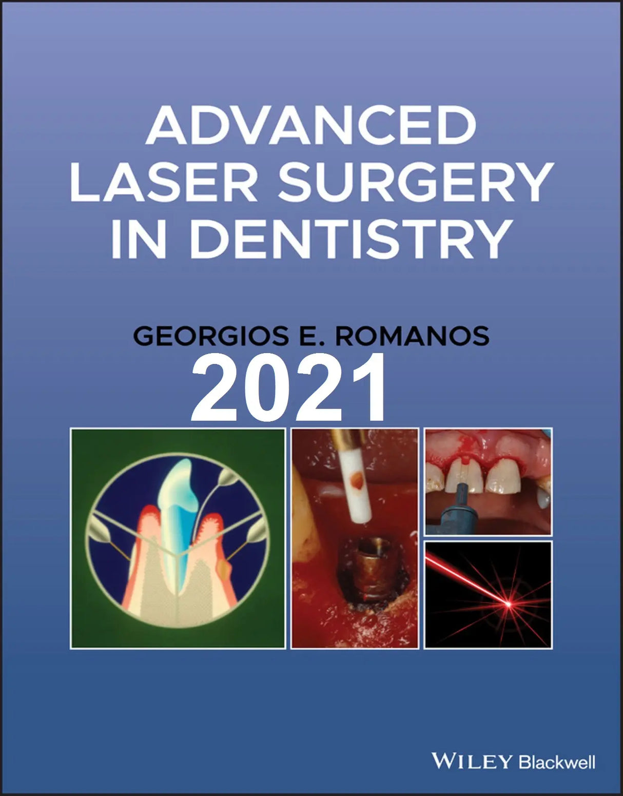 Advanced Laser Surgery in Dentistry 2021