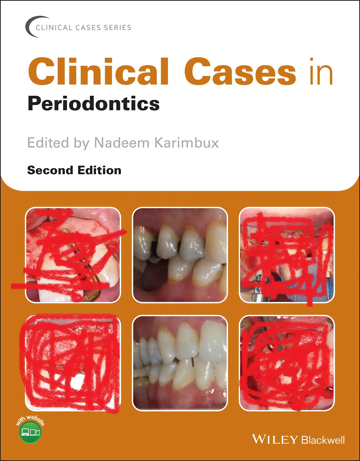 Clinical cases in periodontics 2022