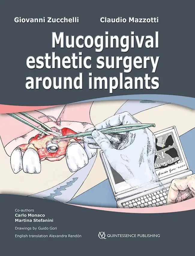 Mucogingival Esthetic Surgery around Implants 2022