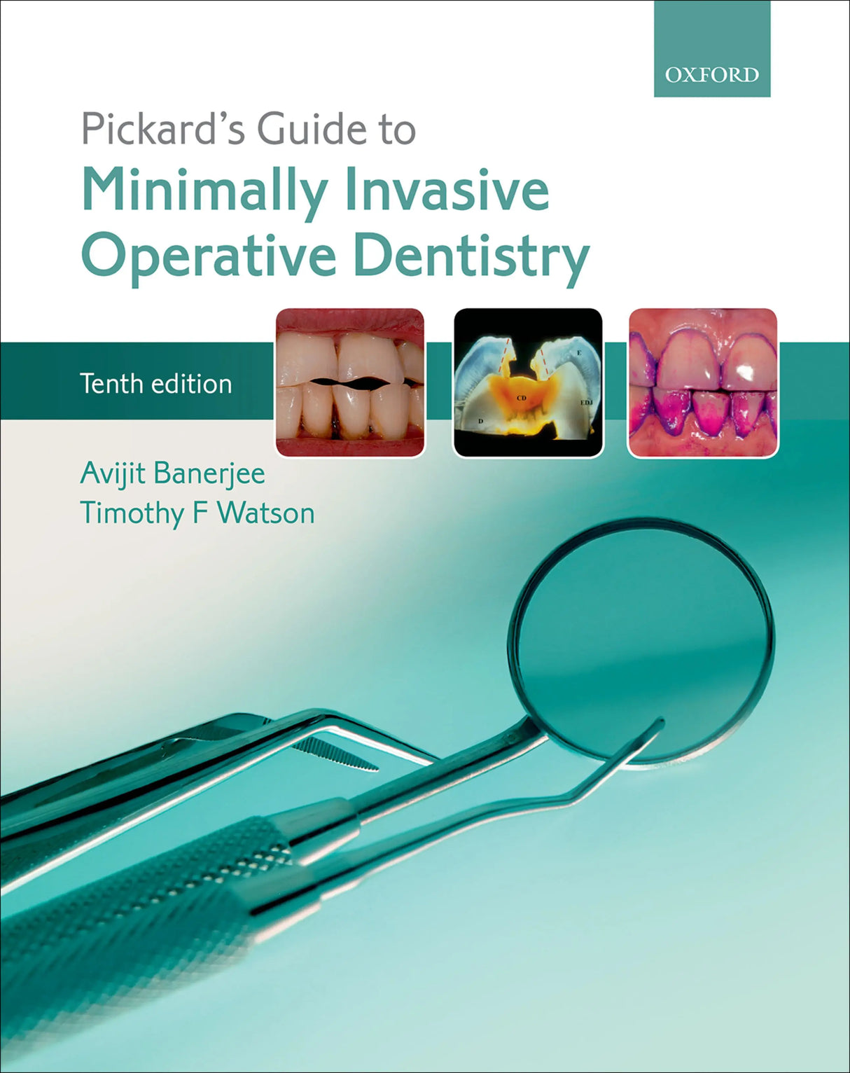 Pickard’s Guide to Minimally Invasive Operative Dentistry 2015