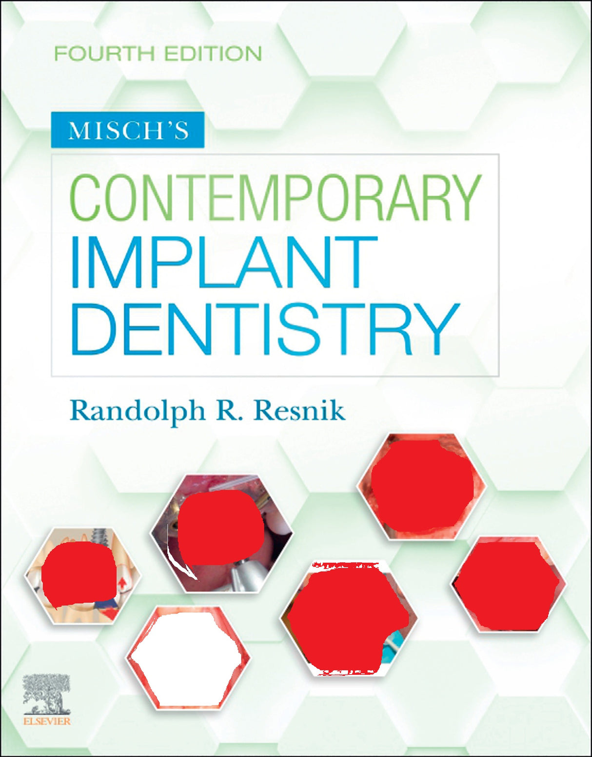 Misch's Contemporary Implant Dentistry 2021