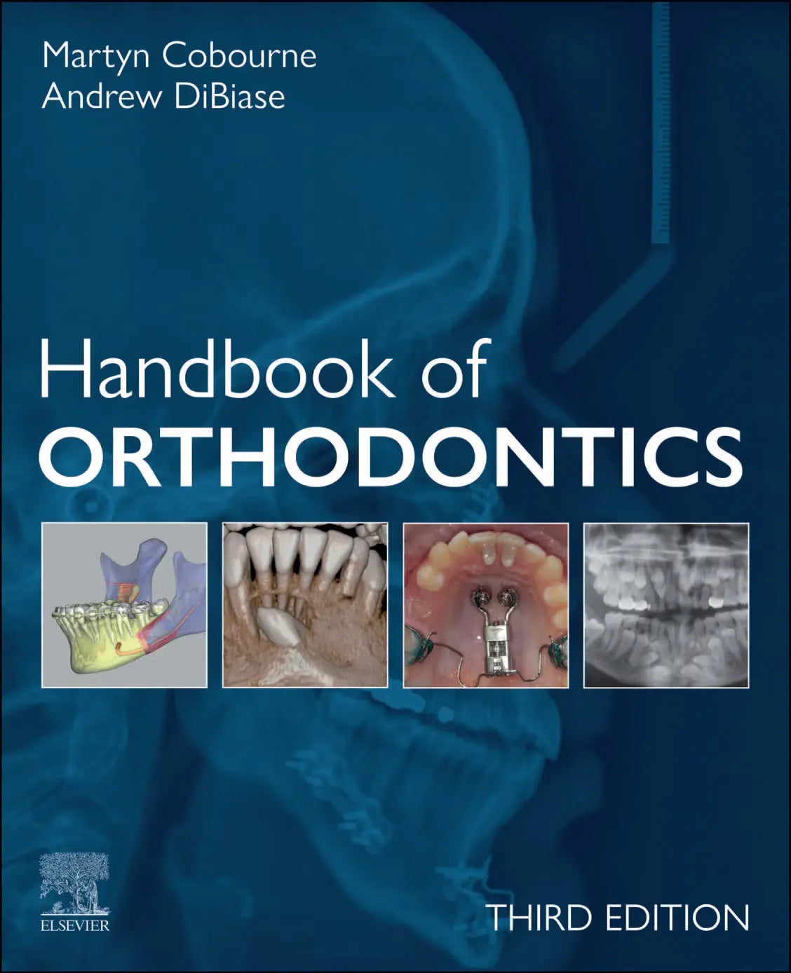 Handbook of Orthodontics 2025