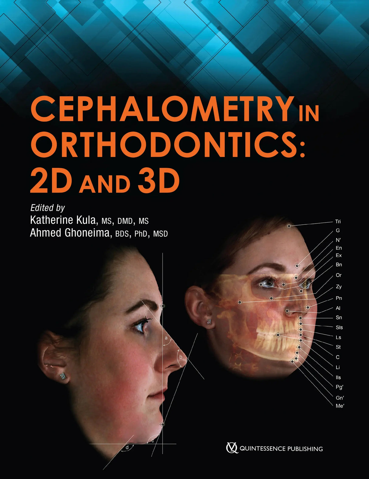 Cephalometry in Orthodontics 2D and 3D 2018