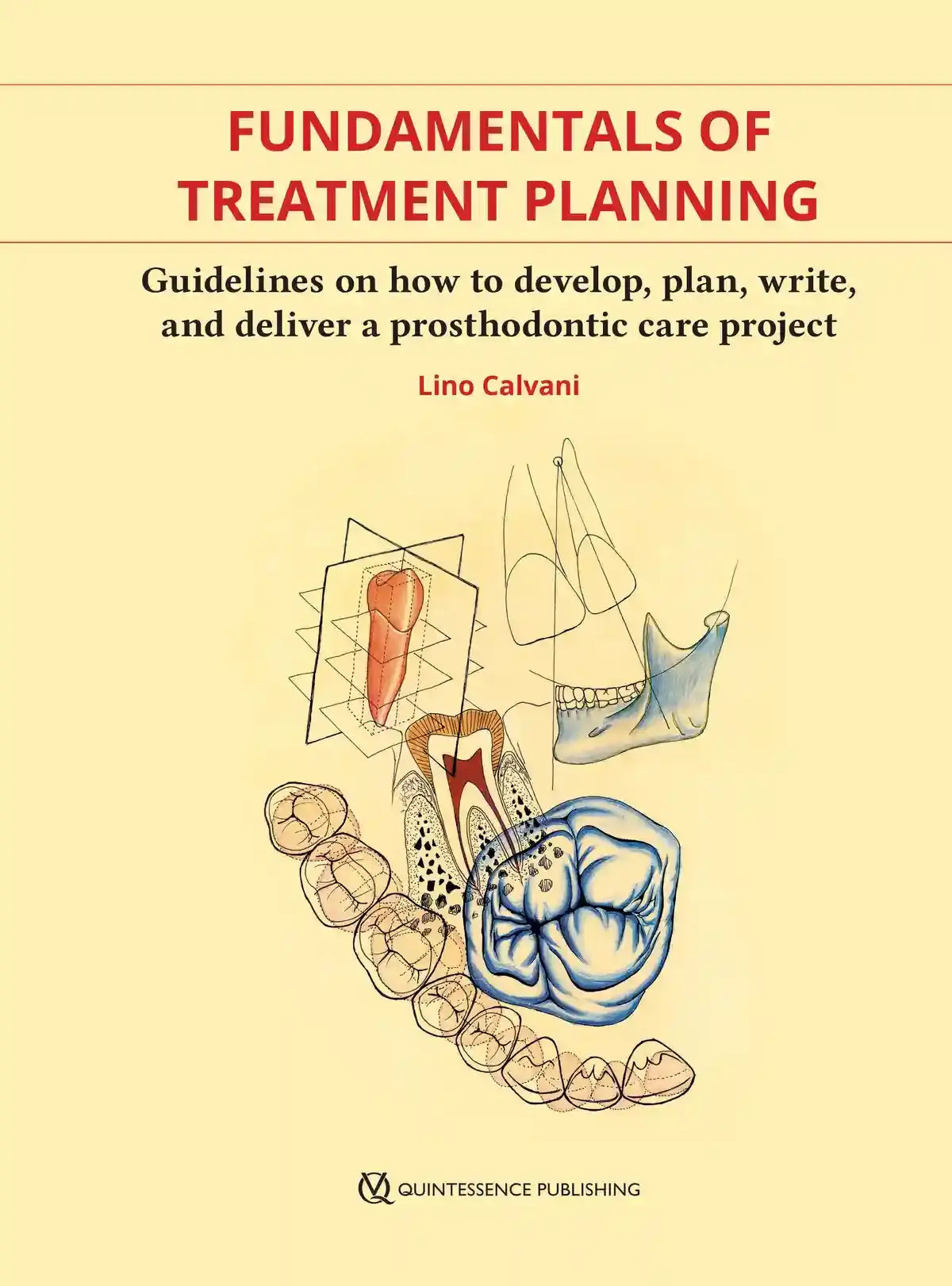 Fundamentals of Treatment Planning Guidelines on How to Develop, Plan, Write and Deliver a Prosthodontics Care Project 2020