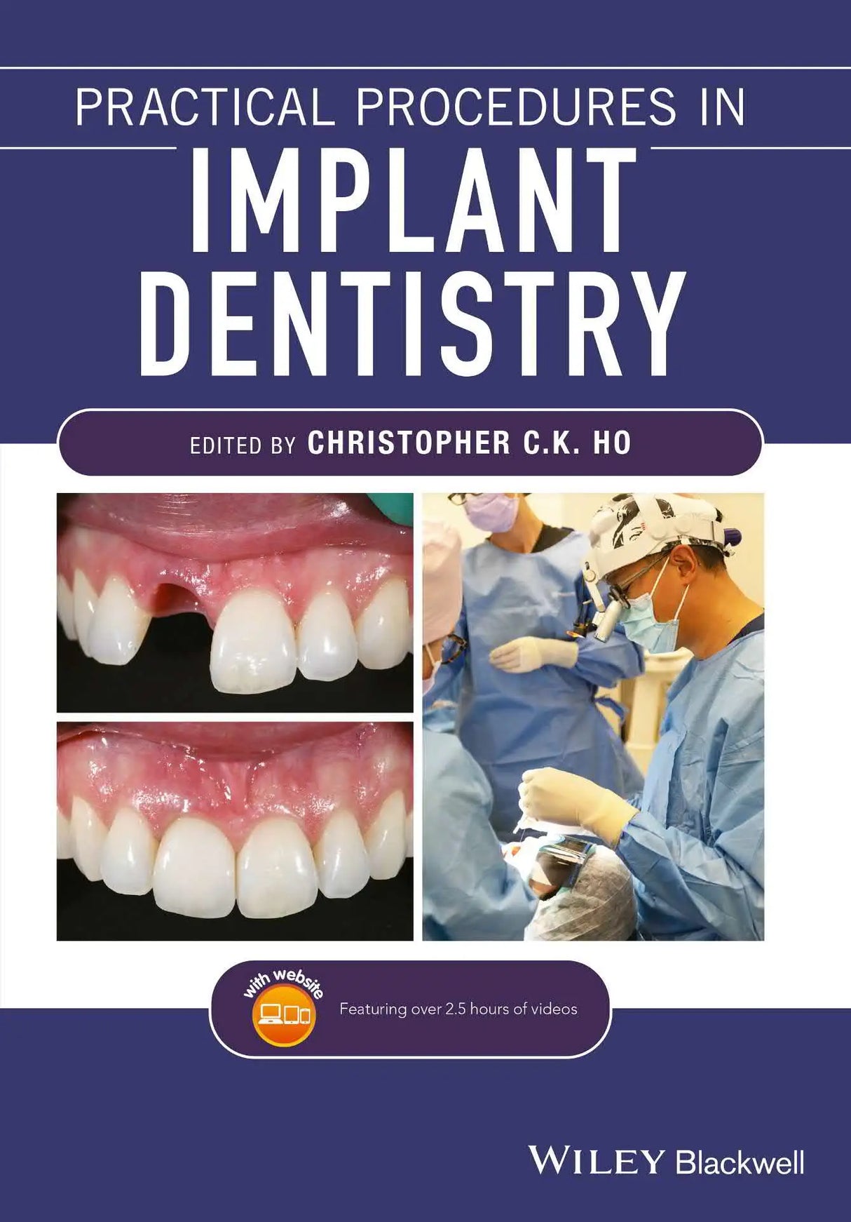 Practical Procedures in Implant Dentistry 2022