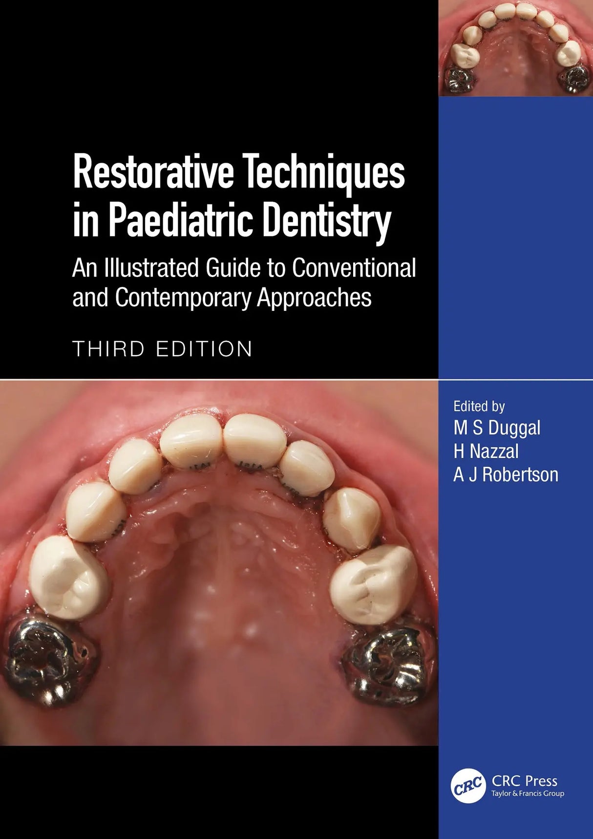 Restorative Techniques in Paediatric Dentistry 2024
