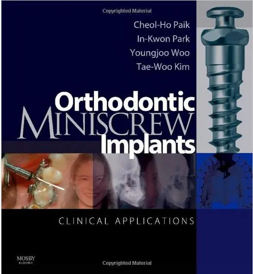 Orthodontic Miniscrew Implants clinical applications 2009