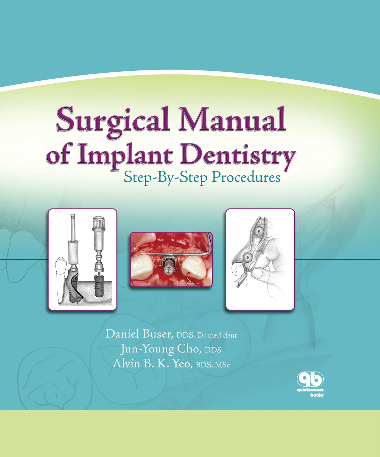 Surgical Manual of Implant Dentistry Step-By-Step Procedures 2007