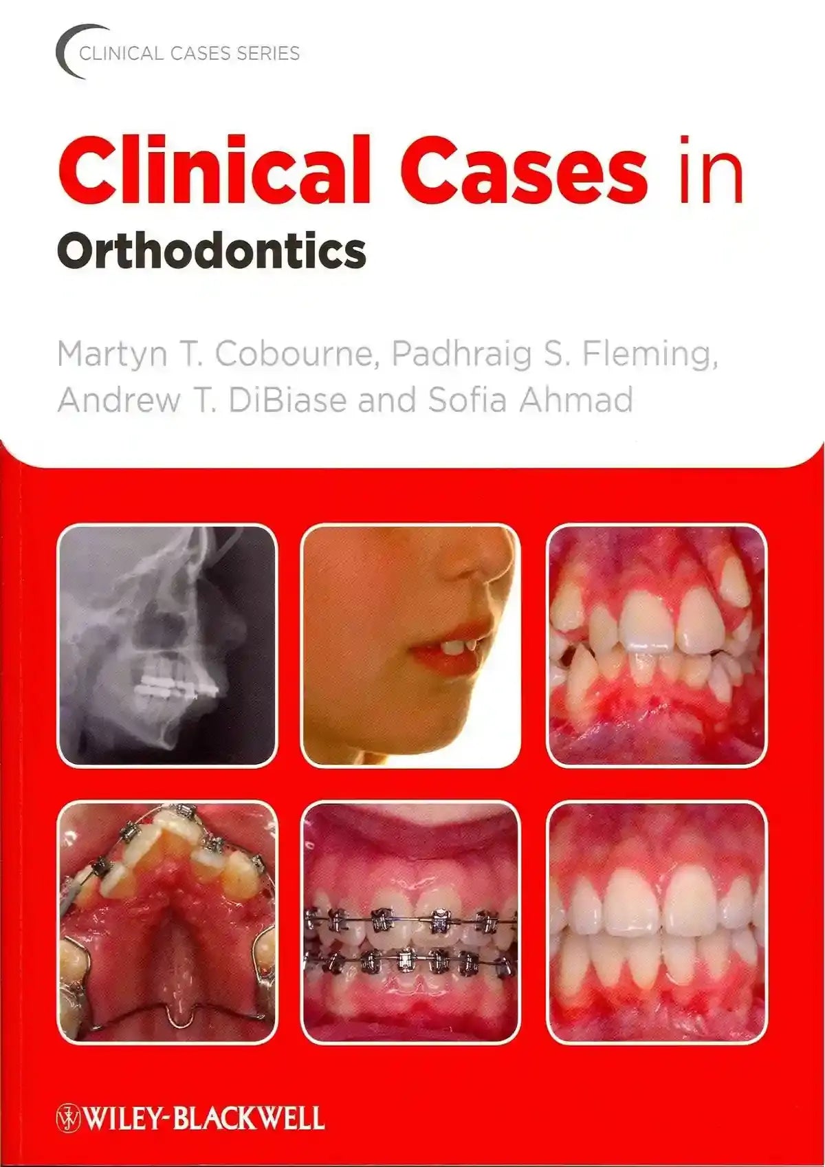 Clinical Cases in Orthodontics 2012