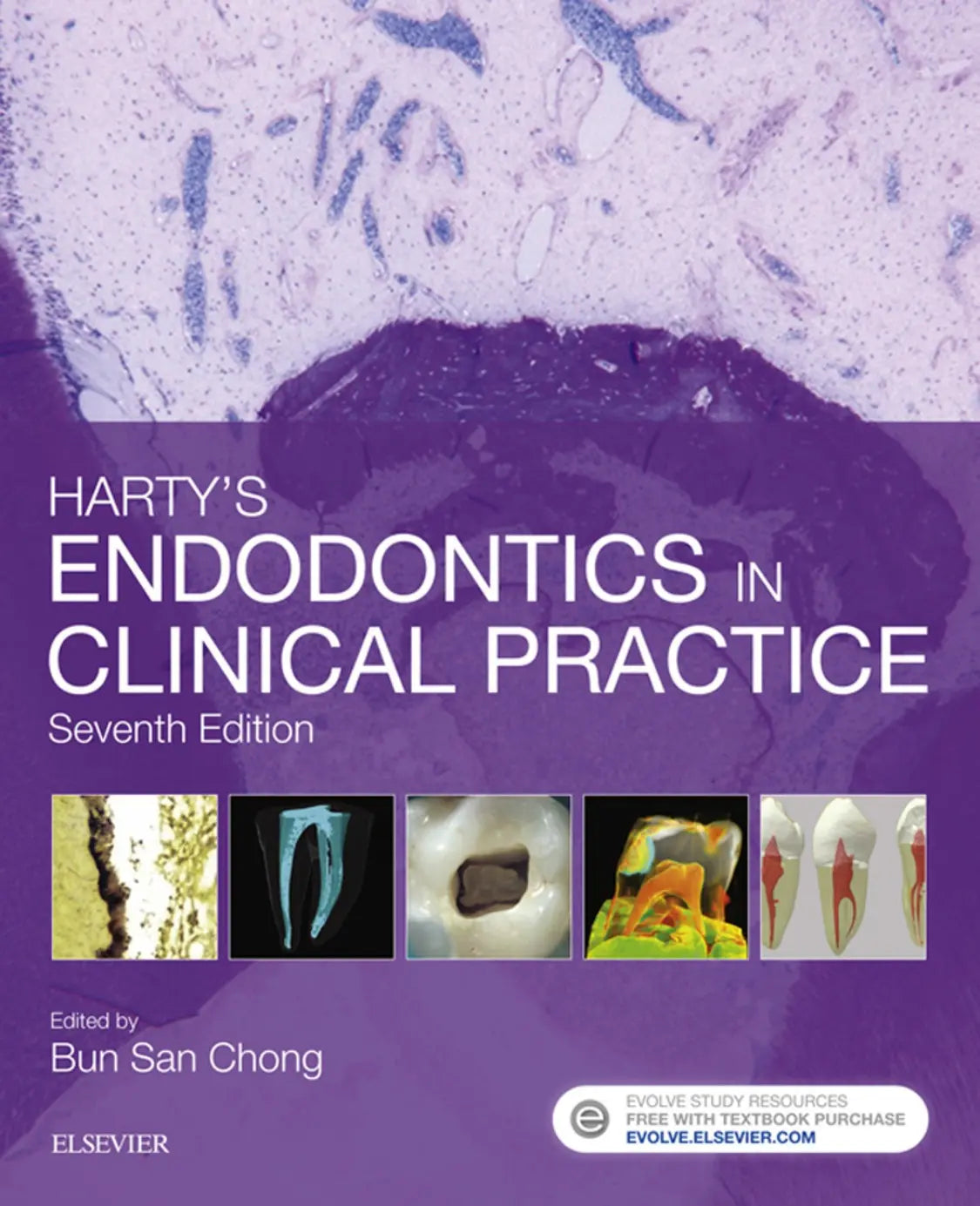 Harty's Endodontics in Clinical Practice 2017