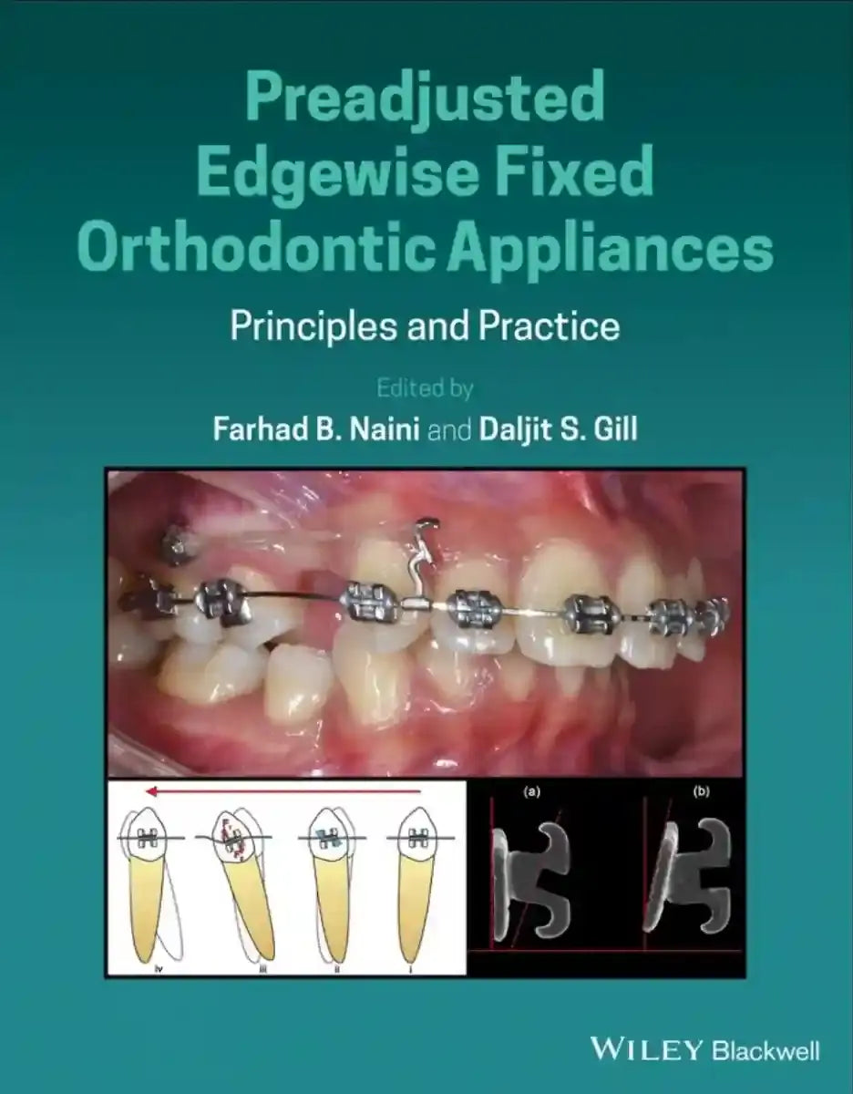 Preadjusted Edgewise Fixed Orthodontics Appliances 2022