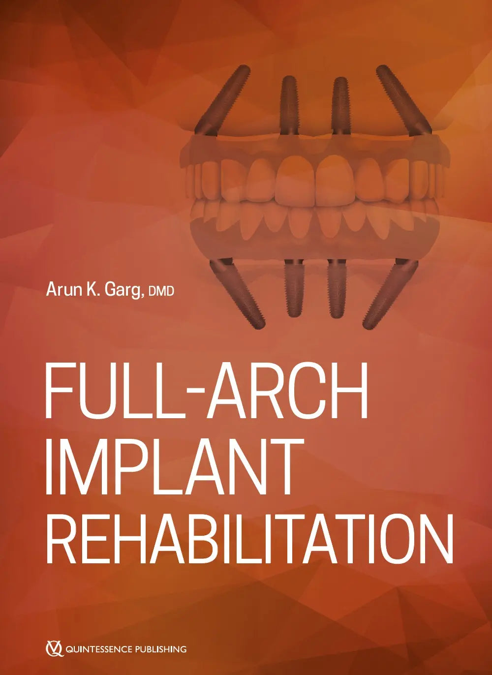 Full-Arch Implant Rehabilitation 2019