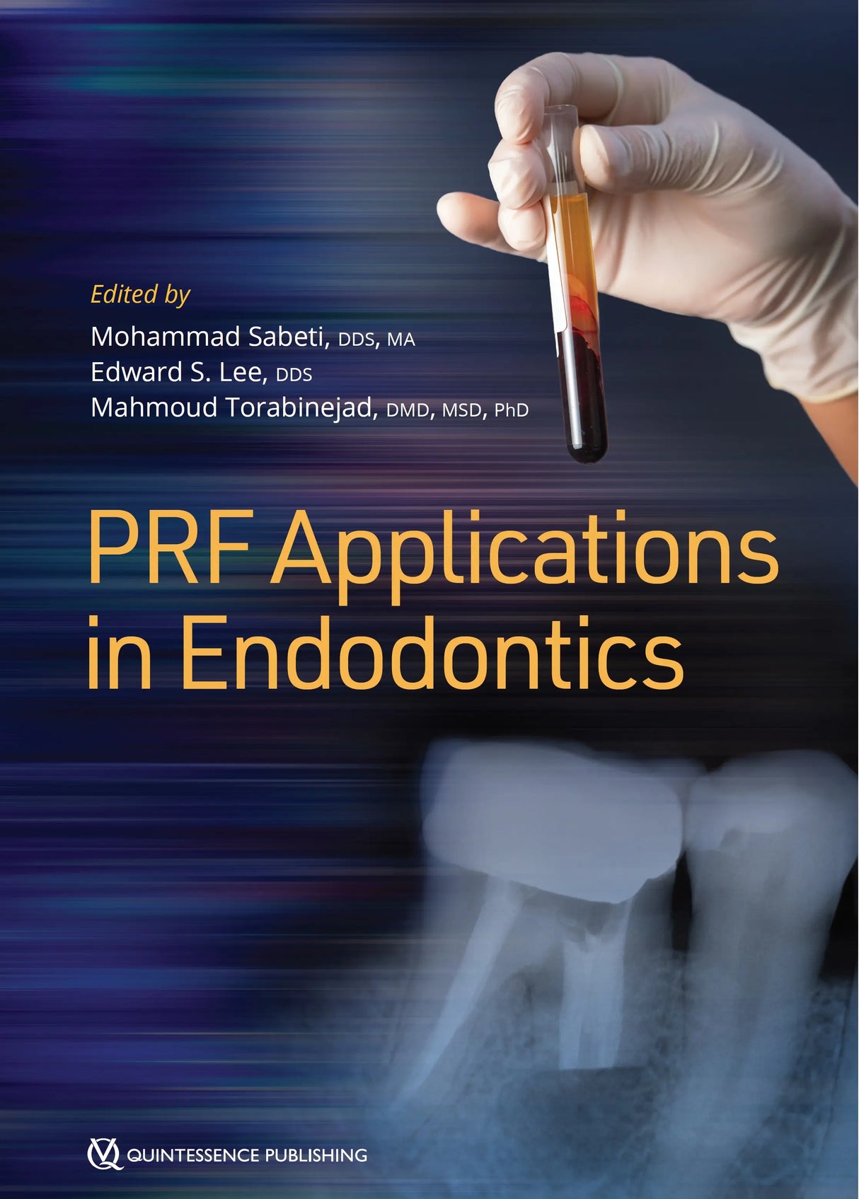 PRF Applications in Endodontics 2020